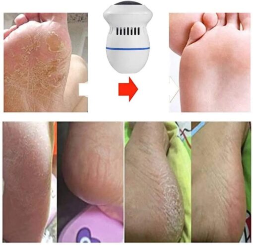 Electric Foot Files Grinder - Image 4